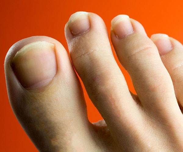 Ngón chân trỏ dài hơn ngón cái thì sao? Giải đoán vận mệnh